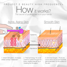Load image into Gallery viewer, D'arsonval High Frequency Wand Argon | Argon Gas Purple Violet Skin Care Acne Spot Pimple Removal Remover Skin Face Tightening Lifting Puffy Eyes Beauty Therapy Facial Treatment Portable Device