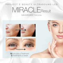 Load image into Gallery viewer, Facial &amp; Eye Photon Ultrasonic Device | 3 Colors LED Red Blue Green Ultrasound Micro Vibration Facial Rejuvenation Skin Tightening Wrinkle Acne Spot Freckles Removal Toning Skin Care Beauty Home Use
